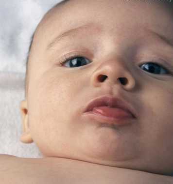 婴儿湿疹常见的几种病因以及如何治疗