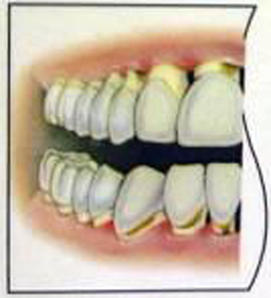 牙齿松动小心身体机能退化
