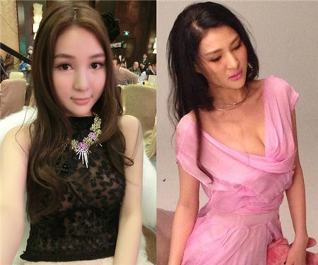 郭美美闺蜜曝其赴韩整容常耍大牌