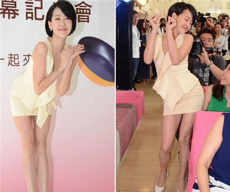 小S晕眩疑家族遗传 大S也曾发病