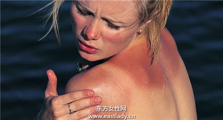 秋老虎發威 一女子皮膚曬傷起水泡