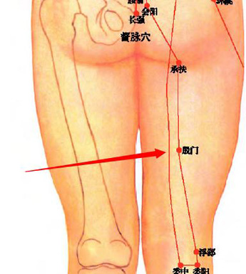 坐骨神經痛 治療坐骨神經痛可按摩哪些穴位