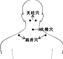 大椎穴位位置图,疏通督脉经络调畅气血