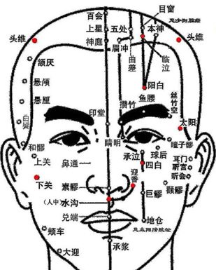 焦式头针疗法 各刺激区的定位及主治疾病