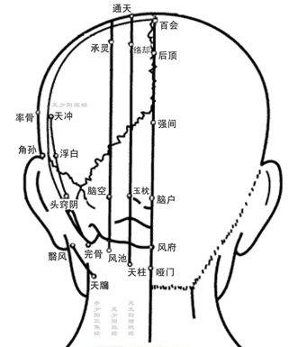 焦式头针疗法 各刺激区的定位及主治疾病