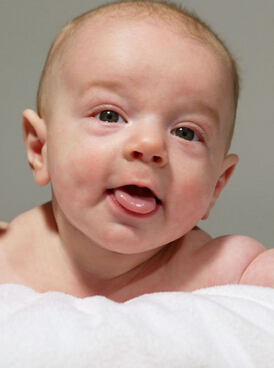 育兒百科,寶寶的小舌頭暗示的疾病征兆
