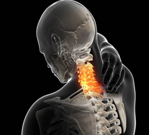 颈椎是身体重要部位 颈椎错位症状