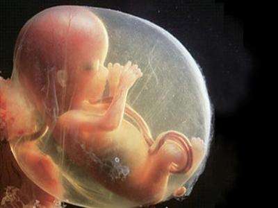 怀孕四个月胎儿图