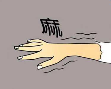 手麻的原因，其原因层出不穷