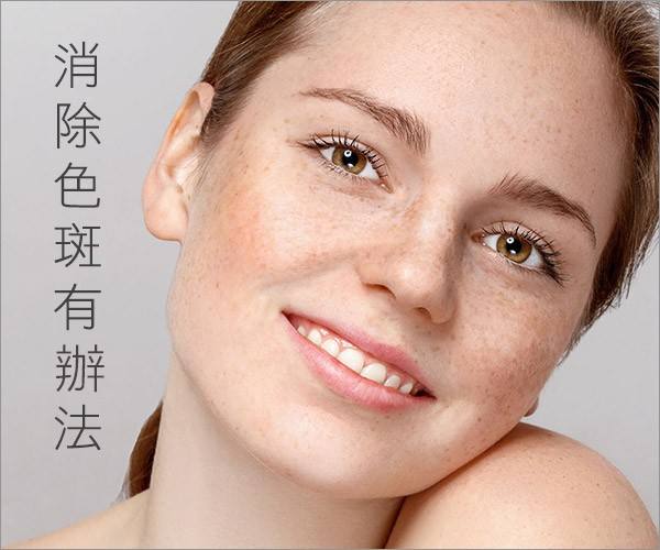 满脸色斑怎么办 十种方法帮你解决烦恼