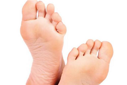 什么方法治脚臭最好 几种治疗脚臭的绝招让你从此远离脚臭