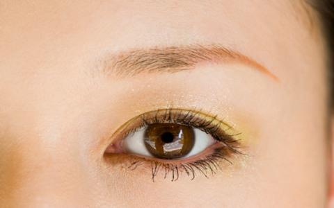 常见的一种皮肤问题 眼皮松弛下垂 