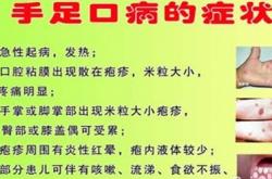 手足口病的预防措施以及它的治疗方法