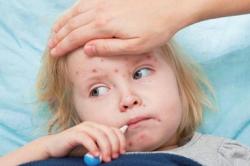 脑膜炎有什么症状，家长发现这些症状时要警惕