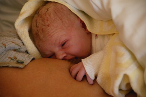 母乳性黄疸的原因以及要怎么治疗