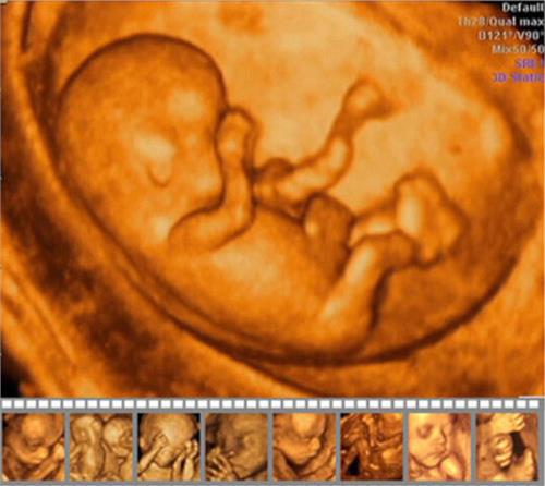 胎心率看胎儿性别 鉴别胎儿性别的妙方