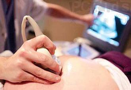 胎心率看胎儿性别 鉴别胎儿性别的妙方