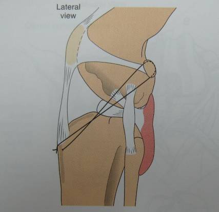 韧带断裂 保护好韧带这个骨骼连接器