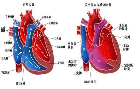心源性呼吸困难是严重的呼吸系统疾病