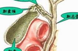 胆囊炎的症状以及治疗方法