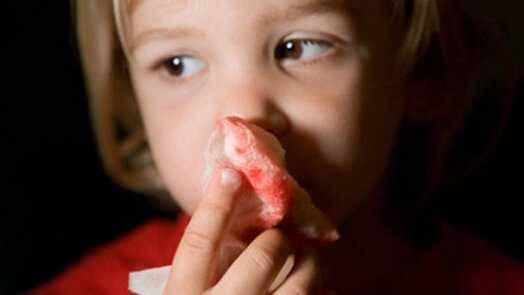 小孩流鼻血怎么办 最简单的方法止血方法