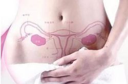 子宫内膜异位的症状有哪些 专家称这样预防