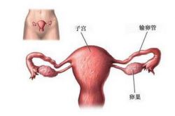 引起子宮畸形的原因 月經異常當心 雙子宮