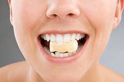牙齿美白方法有哪些 十大方法让你拥有一口洁白牙齿