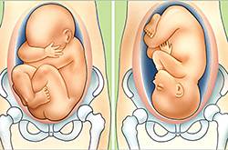 胎儿多少周入盆 胎儿脐带绕颈应这样做