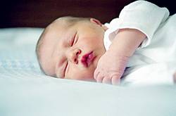 新生儿窒息的病因 新生儿窒息的症状有哪些