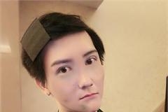 蛇精男刘梓晨融掉脸上50多支玻尿酸模样大变 嘟