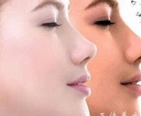 改善肤色的食物有哪些?
