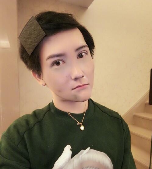 刘梓晨融掉脸上50多支玻尿酸模样大变 高鼻梁嘟嘟嘴不见了