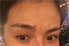 刘涛晒素颜照脸上痘痘吓人 原来她真实肤色这么