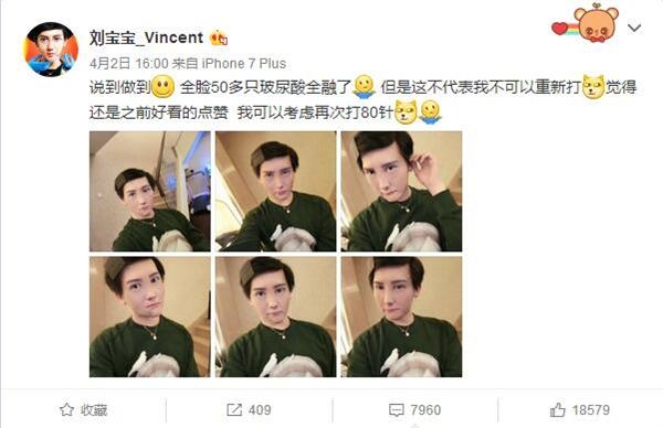 刘梓晨融掉脸上50多支玻尿酸模样大变 高鼻梁嘟嘟嘴不见了