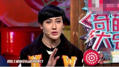 刘梓晨融掉脸上50多支玻尿酸模样大变 高鼻梁嘟嘟嘴不见了