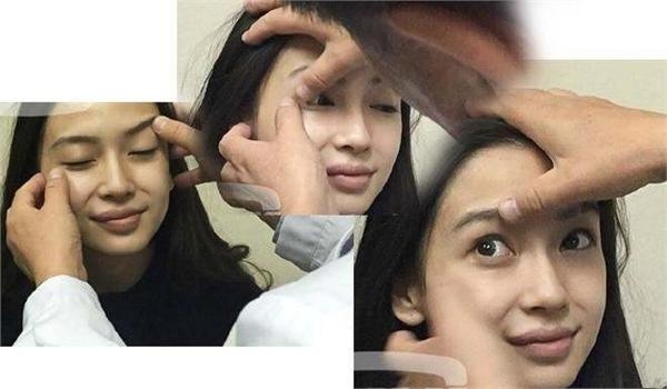 给baby做整容鉴定的医生说出实情 其中一句话耐人寻味
