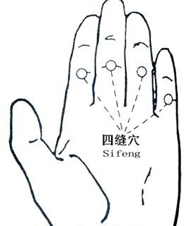 胃胀气怎么按摩排气