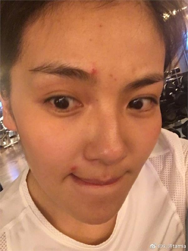 刘涛晒素颜照脸上痘痘吓人 原来她真实的肤色这么黑