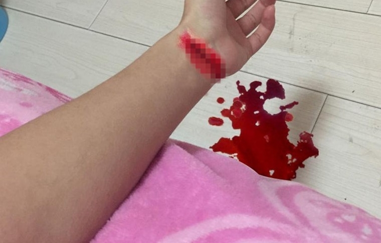 女子直播割腕昏迷