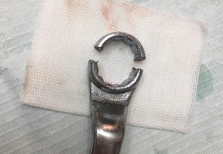 男子下体被扳手套住
