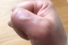 刘若英晒煎鱼被烫伤  调侃给自己手上炸了条”鱼