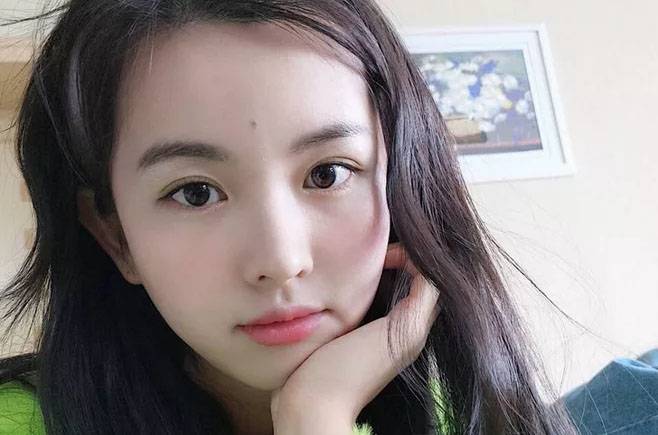 脖子落枕了怎么样能好的快 8大治疗让你快速恢复