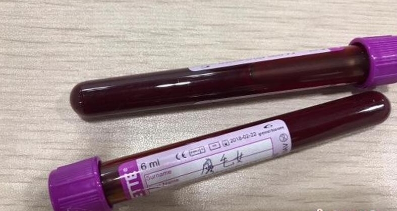 携带百支孕妇血过港