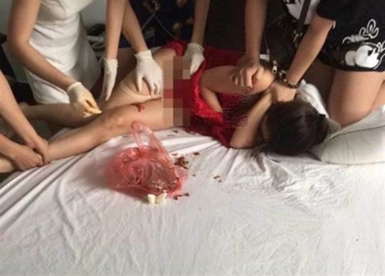 将辣椒塞小三下体