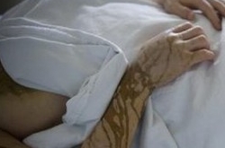 女子往男友身上泼硫酸 被爱情冲昏了脑袋