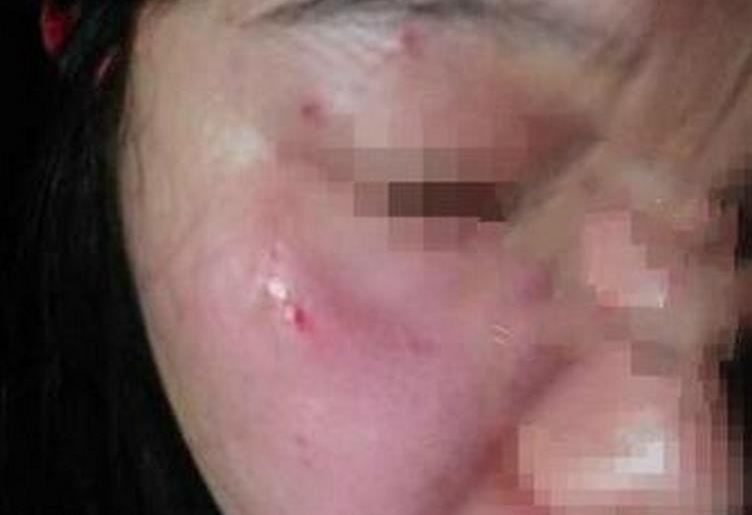 徐峥被曝打女记者