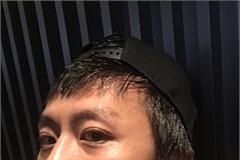 邓超暴瘦到脸全是骨头每两天掉1公斤 虚弱得走路