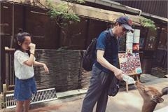 高晓松女儿日本旅行被鹿咬伤哇哇大哭怕变丧尸