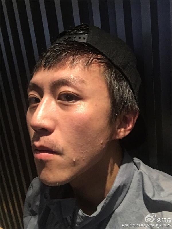 邓超疯狂减肥两天掉1公斤暴瘦到脸上全骨头 走路都要孙俪扶